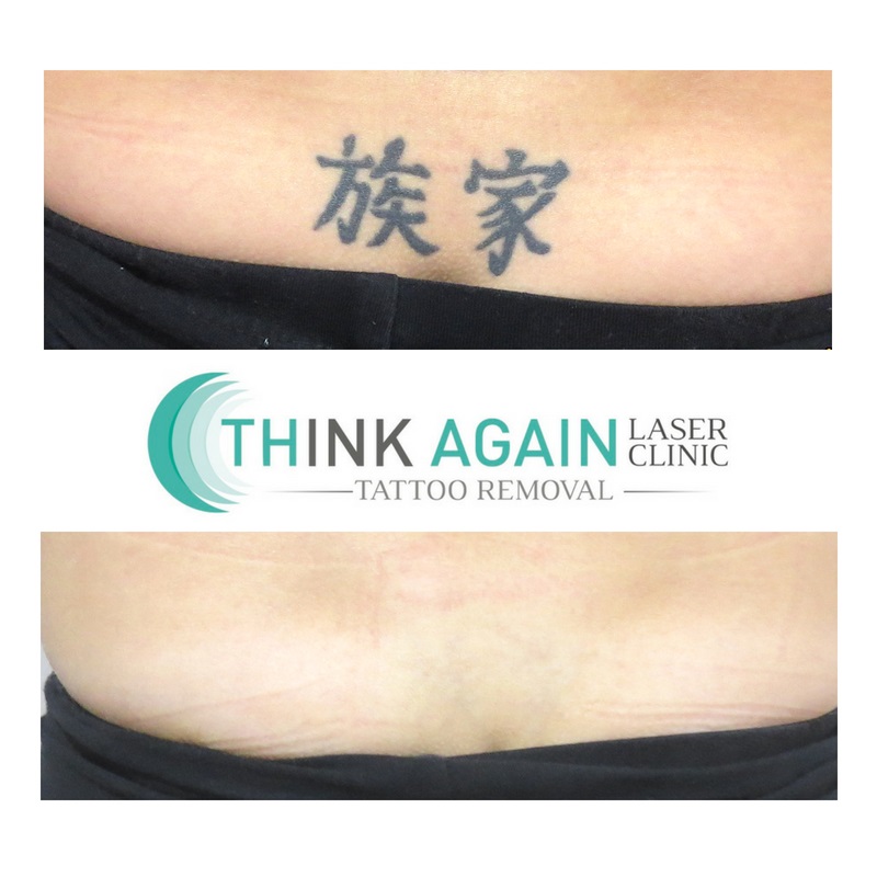 Think Again Laser Clinic - Brisbane