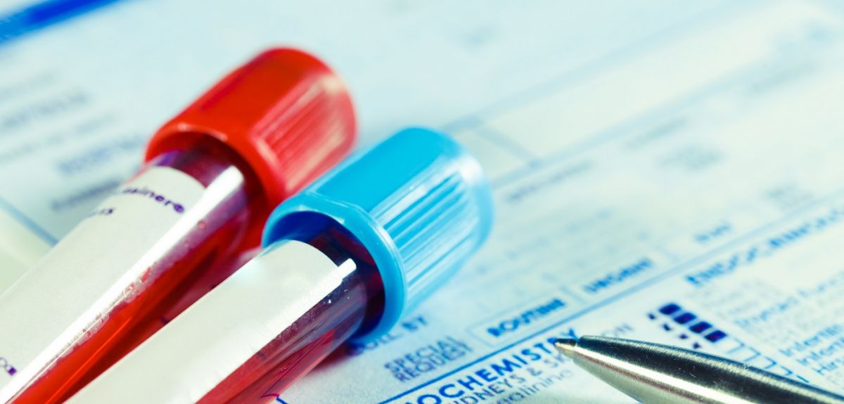 Benefits of Blood Tests for Body Analysis Today