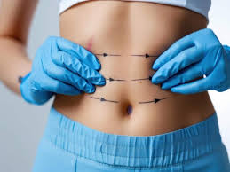 Body Sculpting Treatment: Popular Options Ranked