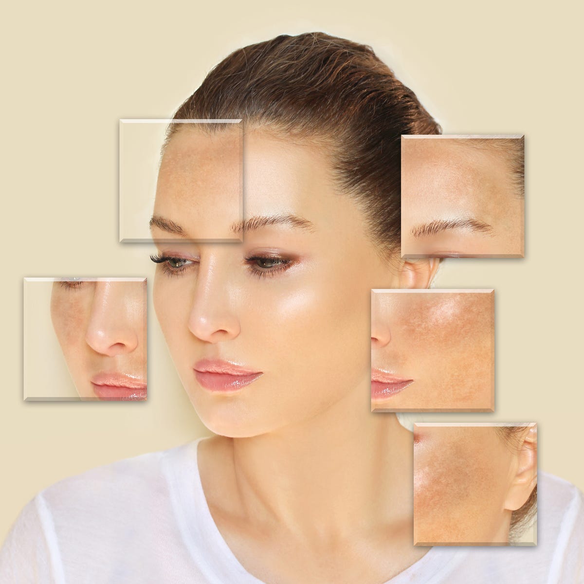 Melasma Treatment: Safe Options for All Skin Types