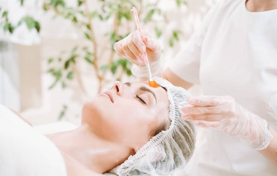 Chemical Peels Can Erase Years Off Your Face