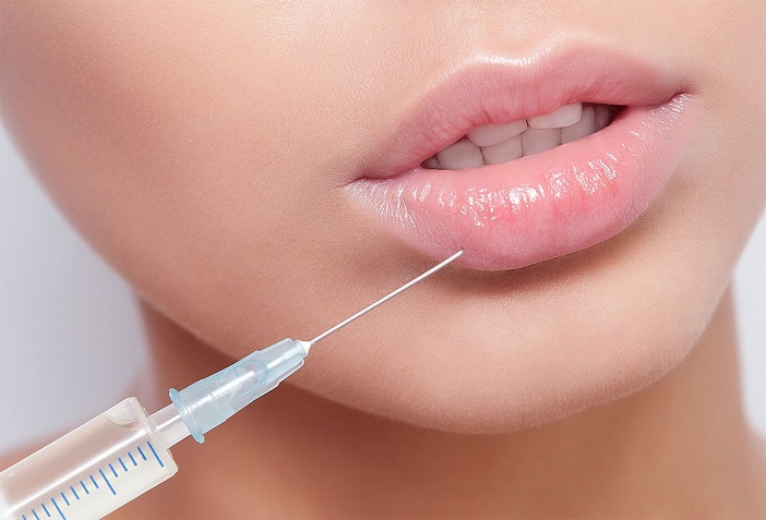 Lip Botox: Small Change, Big Impact on Smile