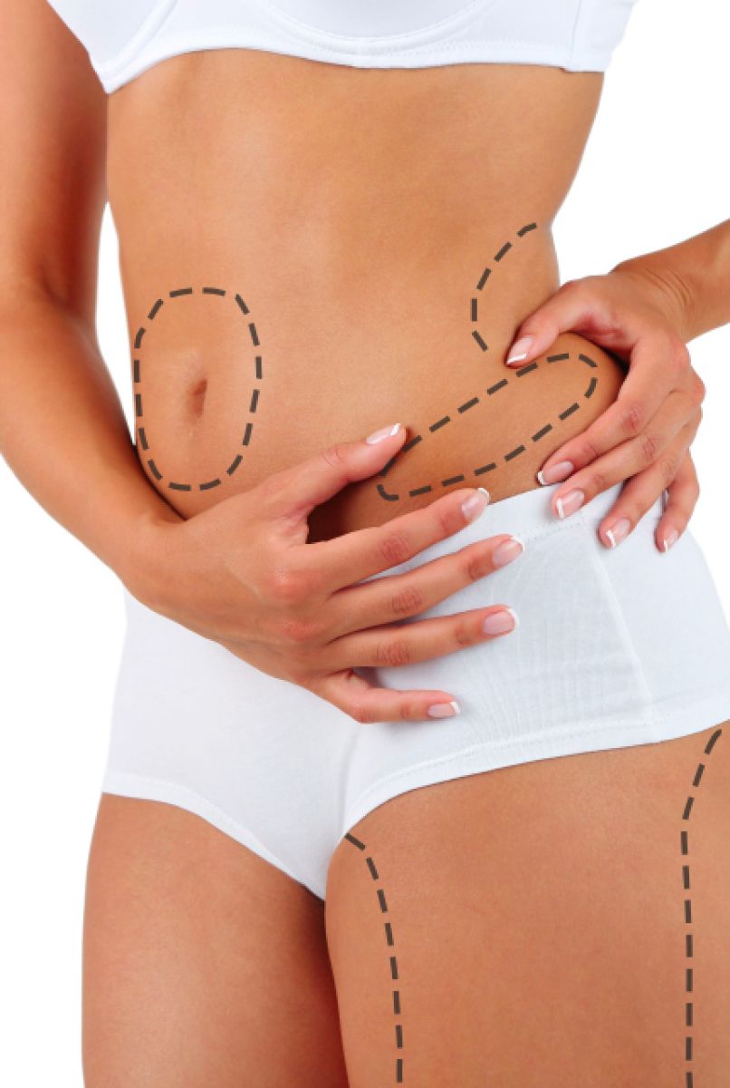 Achieve a Sleek Silhouette with Vaser 4D Liposuction