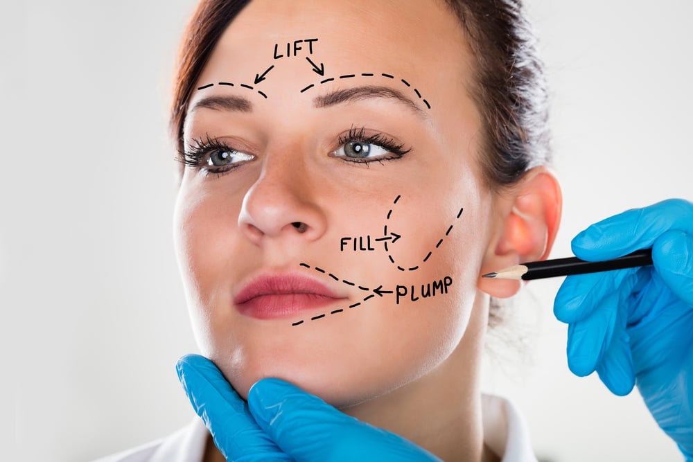 Look Years Younger with Facelift Surgery