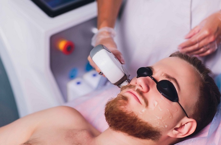 Avoid Pool Swimming After Laser Hair Removal