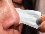 Blackheads Removal Treatment in Dubai UAE