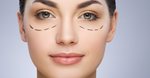 Dark Circles Treatment in Dubai