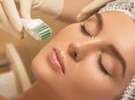 Derma Rollers Treatment in Pakistan