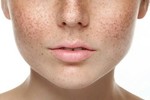 Pigmentation treatment in dubai