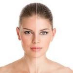 Dermamelan treatment dubai