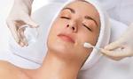 chemical peels in Pakistaan