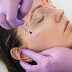 Vampire facial in dubai