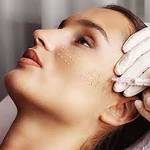Biorevitalization treatment in Dubai