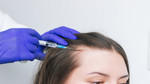 GFC Treatment For Hair In Dubai 