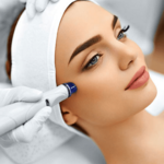 Chemical Peels in Dubai
