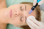 Microneedling Treatment In Dubai