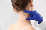 Skin Tag Removal In Dubai and Abu Dhabi