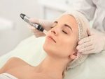 Dermapen Micro-Needling In Dubai