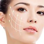 Silhouette Soft Thread Lift in Riyadh