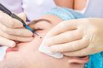 Skin Tag Removal In Riyadh