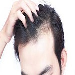 Hair Restoration in Riyadh