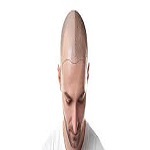 Hybrid Hair Transplant in Riyadh
