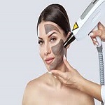Laser Carbon Peel Treatment in Riyadh