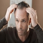 FUE Hair Transplant