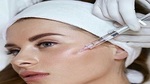 Radiesse Fillers Injections In Dubai