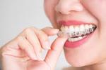 Invisalign Treatment in Islamabad