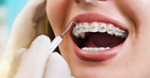 Orthodontists in Islamabad