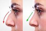  Best Rhinoplasty Clinic in Islamabad