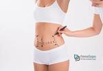 Tummy Tuck in Pakistan 