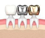 Dental Crowns in Islamabad