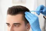 Hair Transplant Procedures
