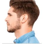 Sideburn Hair Transplant in Dubai ​