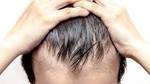 Laser Hair Loss Treatment - How Does it Work?