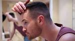 Hair Transplant Dubai