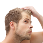 HOW MUCH DOES A HAIR TRANSPLANT COST?