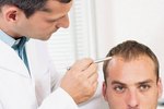The Unique Ways Of Perfect And Best Hair Transplant