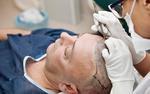 Hair Transplant Centers