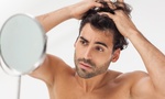 Hair Implants in Dubai 