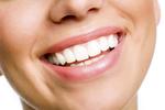 Home Teeth Whitening in Dubai