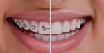 Orthodontics in Dubai