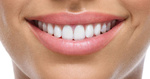 Composite Veneers Dubai