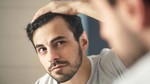Hair Transplants for front head Dubai