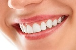  Smile Makeover in Dubai