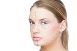 Cheap Cheek Augmentation Cost in Dubai