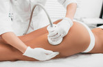 Cellulite Removal in Dubai