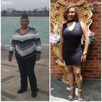 Need to Undergo an Obalon Weight Loss Procedure